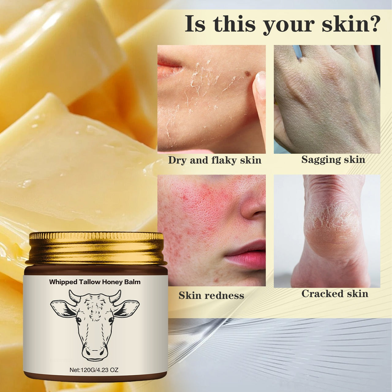 Natural Grass-Fed Beef Tallow Honey Balm – Whipped Moisturizer for Soft Skin