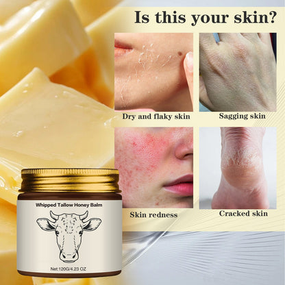 Natural Grass-Fed Beef Tallow Honey Balm – Whipped Moisturizer for Soft Skin