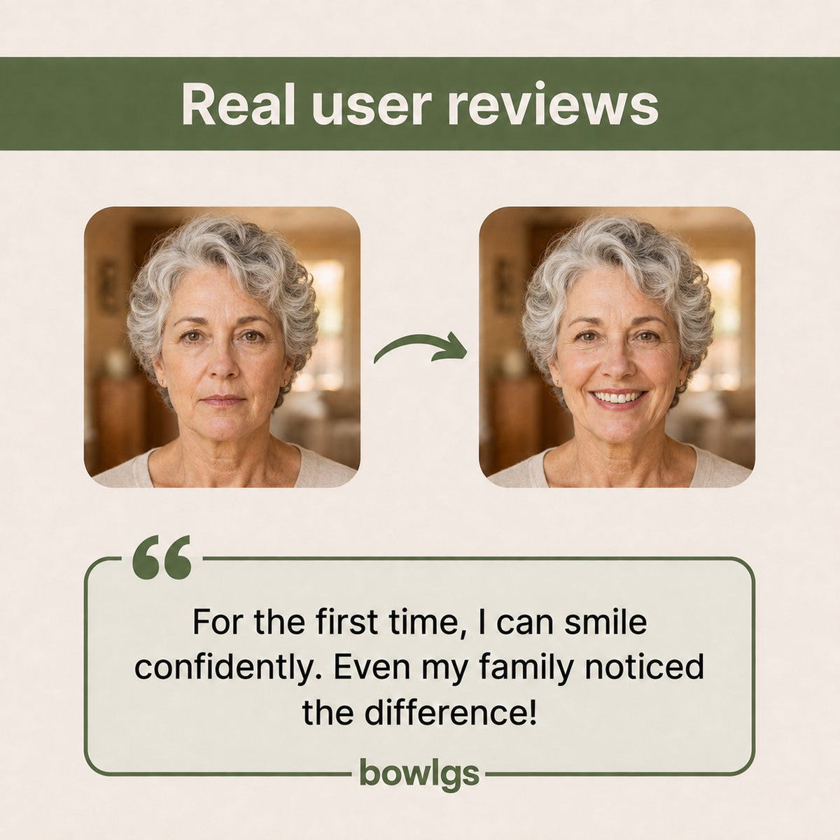 Bowlgs Custom Denture Set