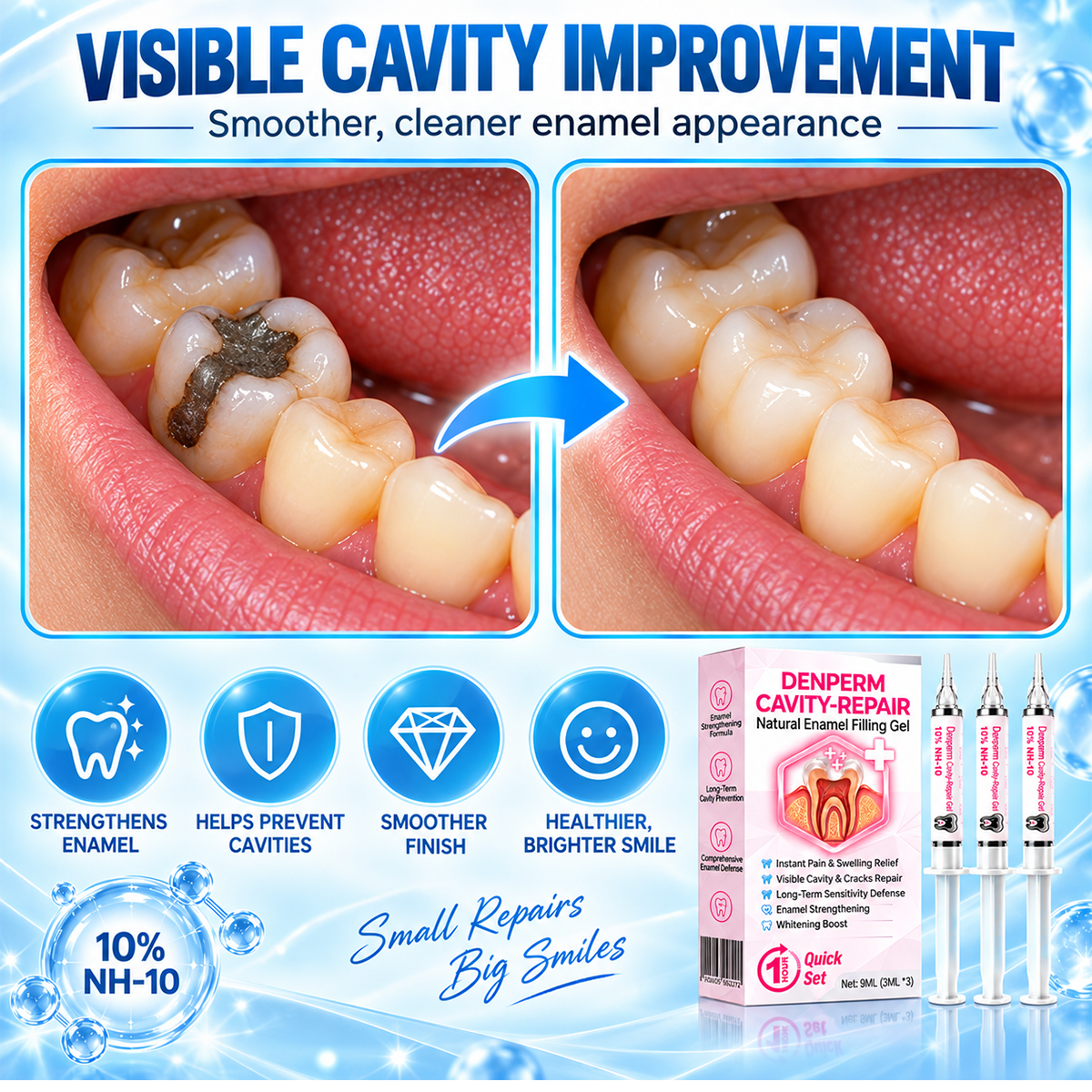 DenPerm Cavity-Repair Natural Enamel Filling Gel